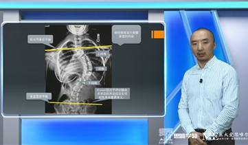 【名师讲解剖学】系列课程——脊柱侧弯的诊断与治疗（上）